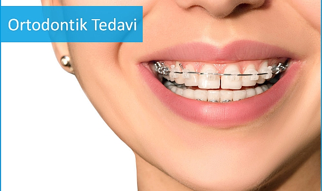 Prof. Dr. Ramoğlu: ‘’Ortodontik tedaviler çürüğe neden olmaz’’