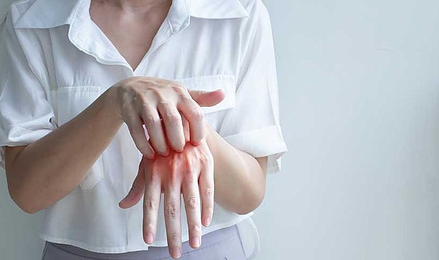 Cildiye profesörü uyardı: “Herkes her an uyuz olabilir”