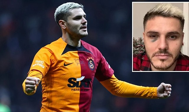Galatasaray'da Mauro Icardi depremi! Bir süre yeşil sahalardan uzak kalacak