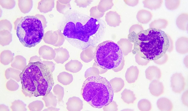 Lökosit Nedir? Vücudumuzun Savunma Hücreleri