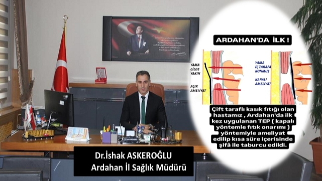 Ardahan'da sağlıkta bir ilk daha!
