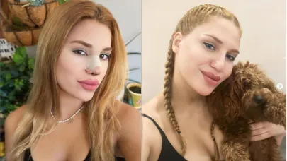 Survivor Almeda 29 kilo verdi, estetik oldu, şimdi boşanıyor mu? Eşi Ercan Baylan'ın yorumu kafaları karıştırdı