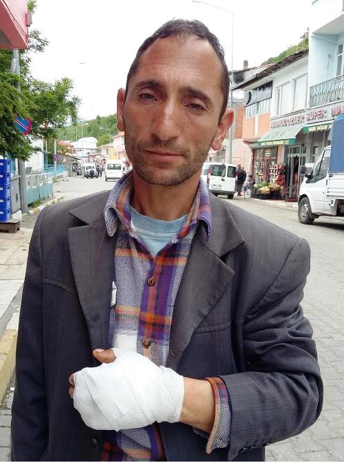 Kendisine saldıran kurdu bıçakla yaralayıp kurtuldu