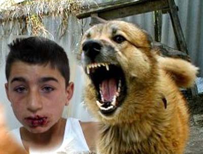 Karagölde köpek saldırısı, 1 kişi yaralandı